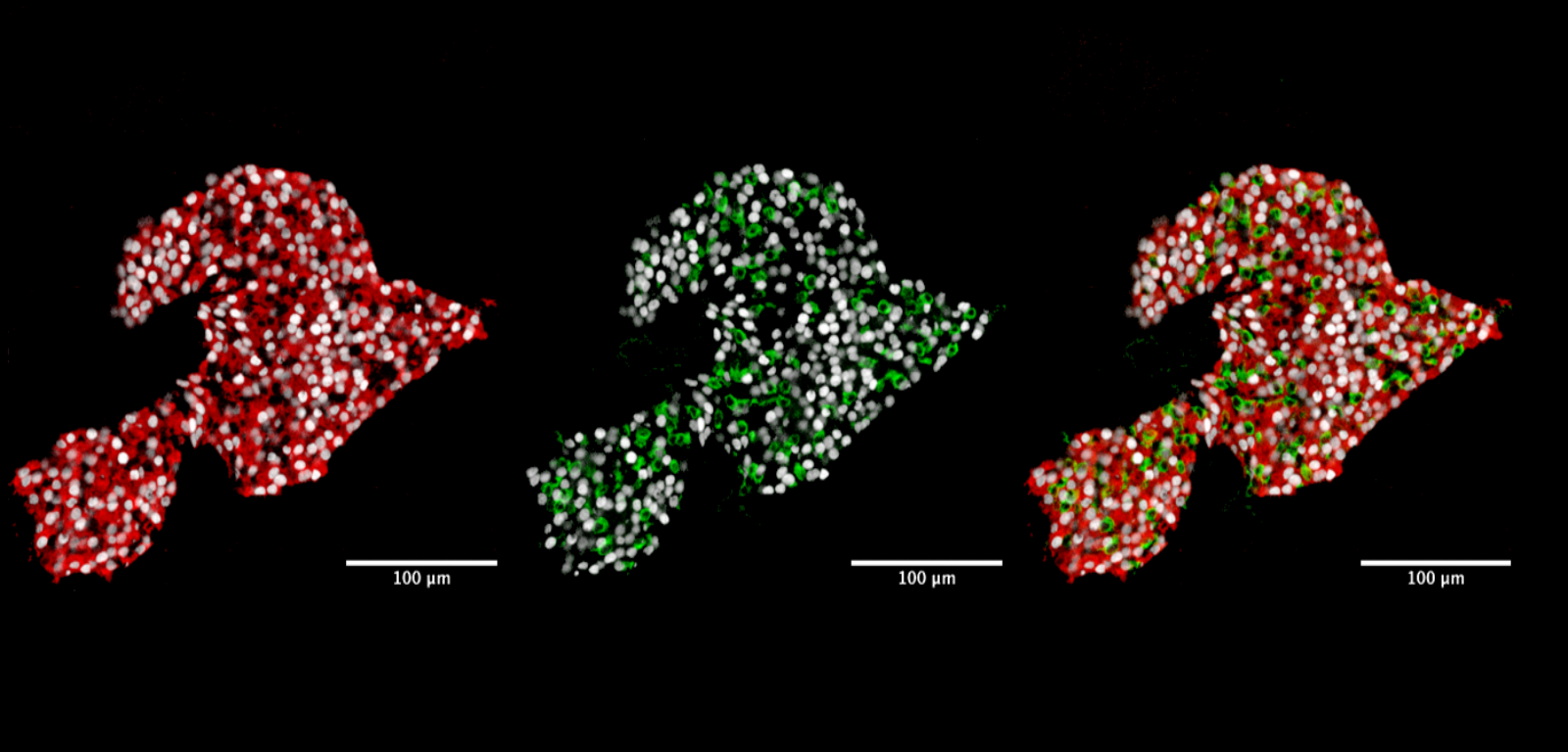 Insulin and glucagon immunostaining of Robo knockout islets